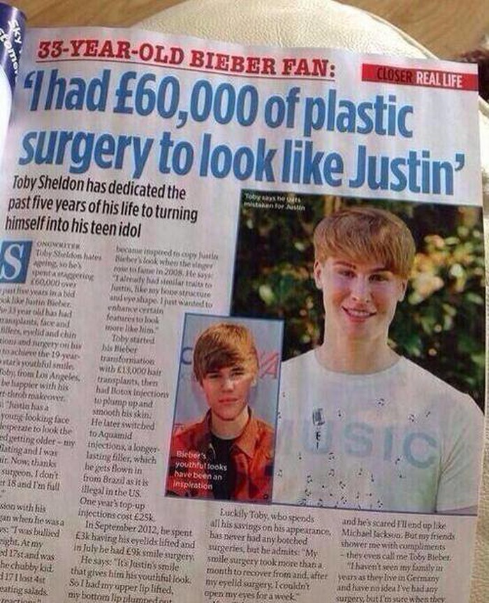 Hrpa plastičnih operacija da bi izgledao kao Bieber?!