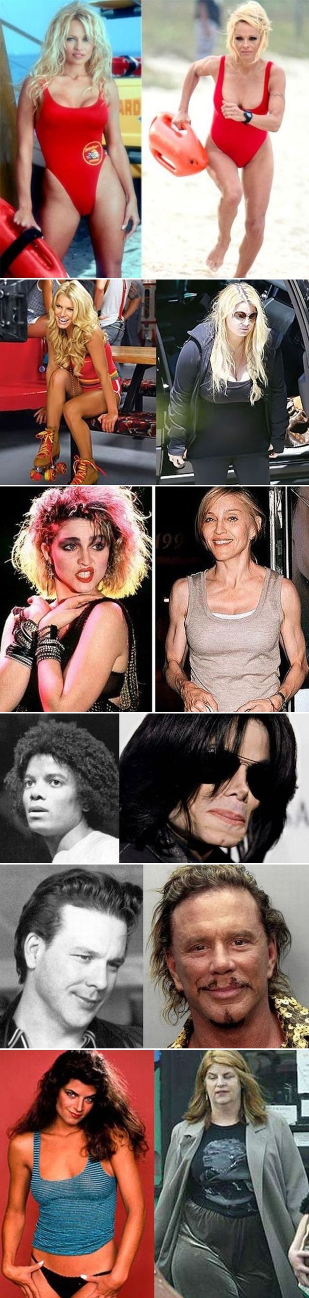 Šokantne fotke celebrityja nekad i sad