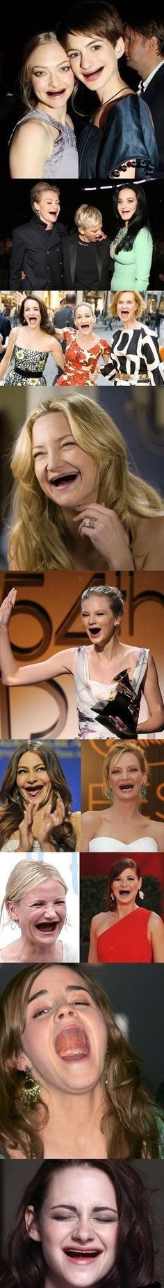 Fotke poznatih bezubih glumica u isto će vas vrijeme zgroziti i nasmijati