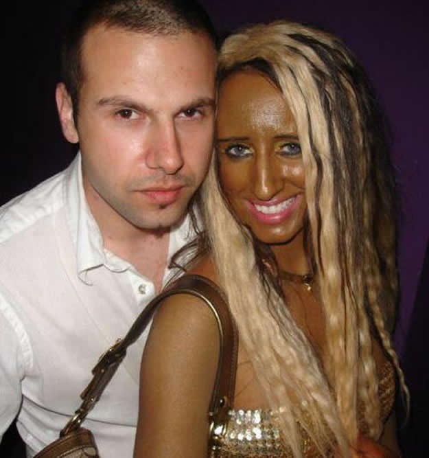 Reš pečene žene: Plaža više nikad neće biti ista