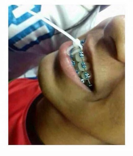 Pronašao je način da ušutka svog rođaka koji je pričao gluposti