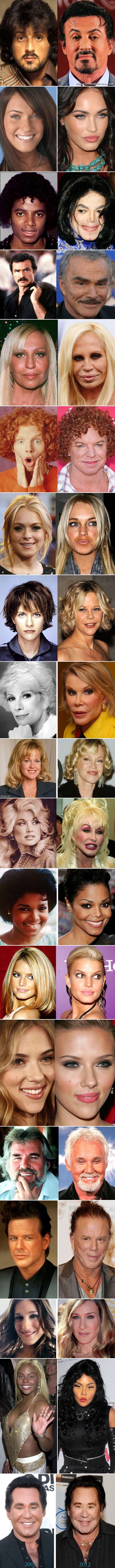 Galerija: Zvijezde prije i nakon što su pale pod nož