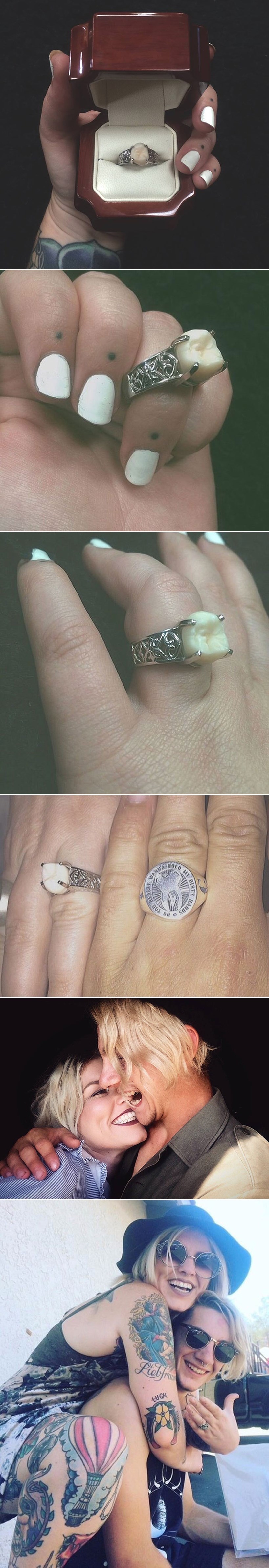 GALERIJA: Zaručio je - umnjakom