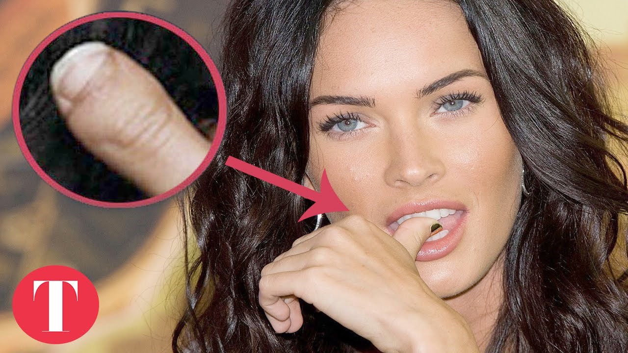 Deset poznatih zvijezda s fizičkim "manama" dokazuje da nitko nije savršen