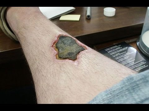 VIDEO Petnaest najgorih ugriza insekata: Pogledajte što se dogodilo ovim ljudima!