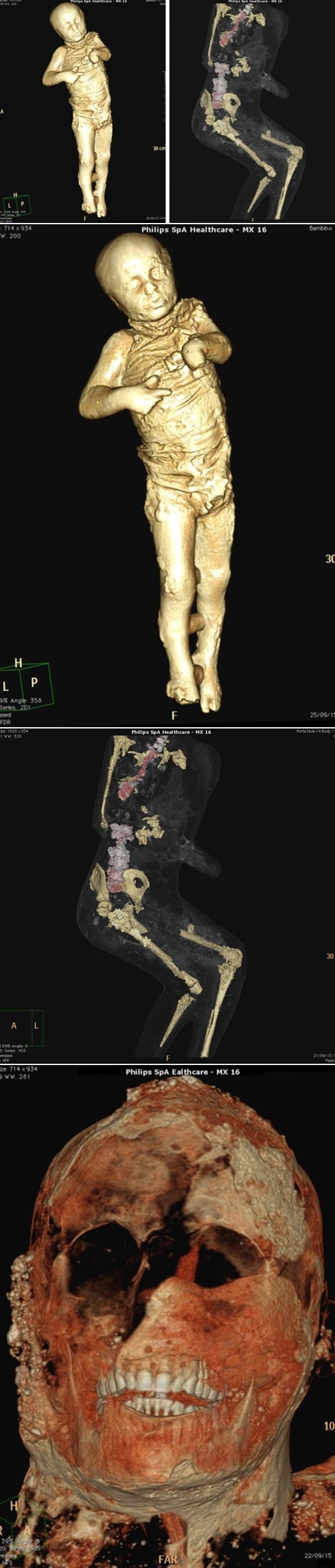 GALERIJA: Žrtve stravične erupcije napokon dobile svoje lice