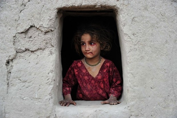 Ovo je pravo lice rata u Afganistanu