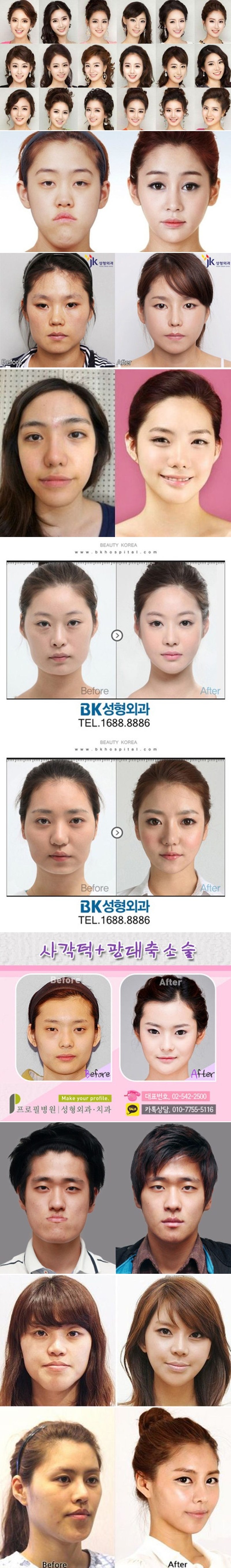 Žene Južne Koreje prije i nakon hrpe plastičnih operacija