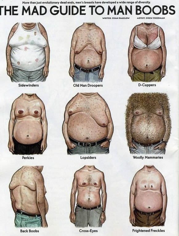 Nemaju samo žene problema s neposlušnom sisom