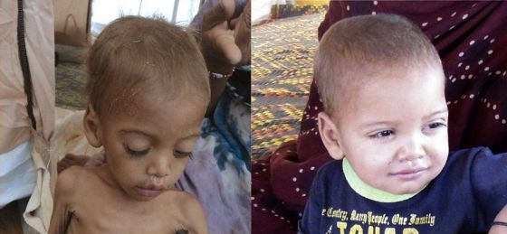 Bebač spašen od gladi dobio priliku za život