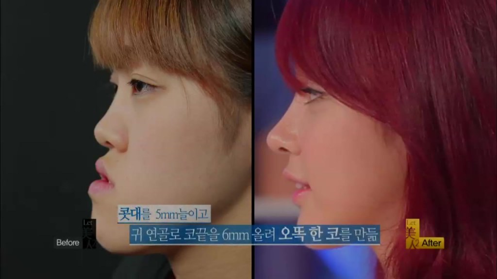 Što može današnja plastična kirurgija