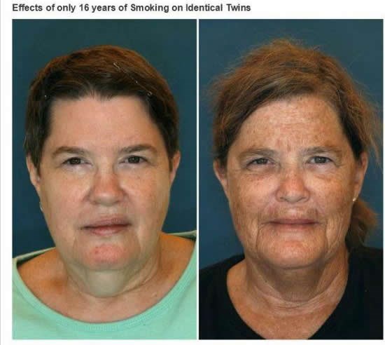 Što ti 16 godina pušenja napravi od lica
