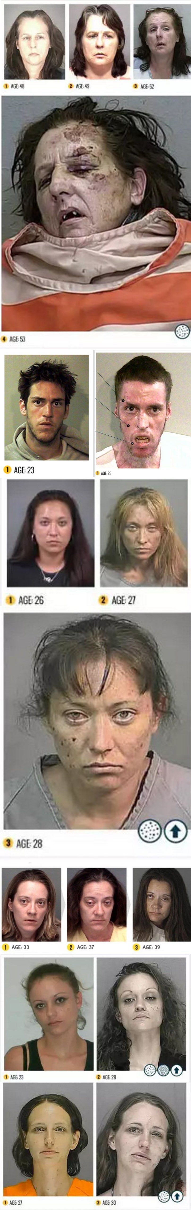 STRAVA I UŽAS crystal metha: Najšokantnije "prije i nakon" fotografije ikad