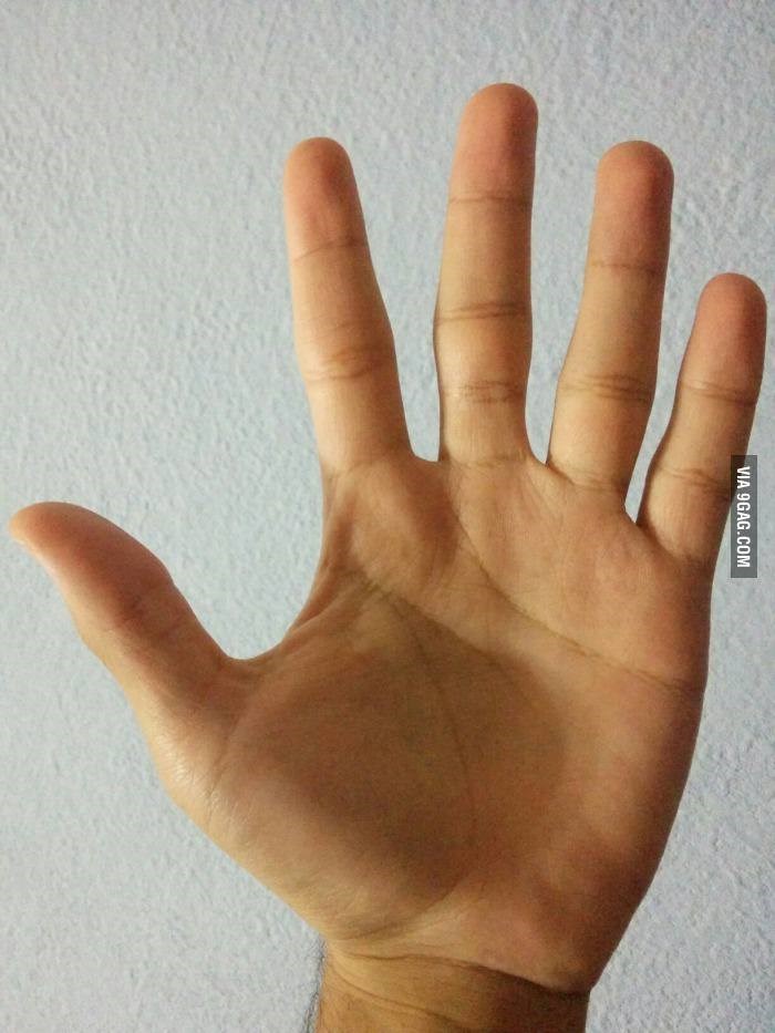 Što ne valja s ovim dlanom?