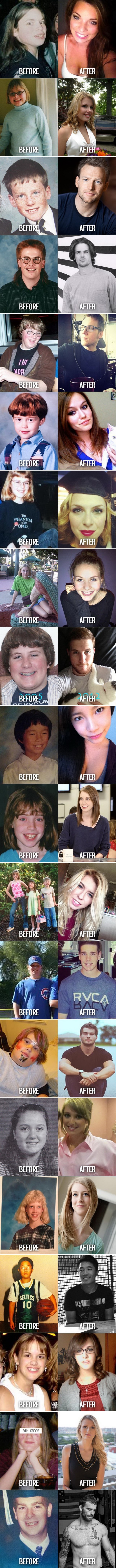 Ružno pače postalo komad na najjače: Nakon puberteta postali seksi do bola