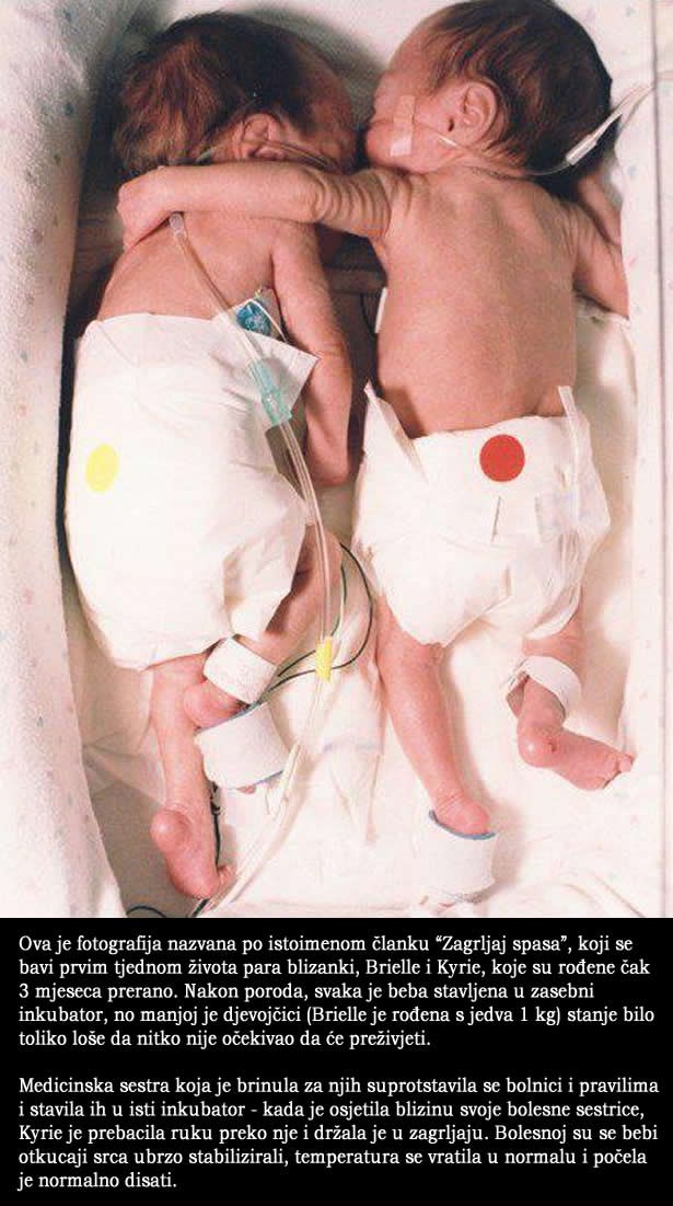 Zagrljaj spasa: Beba spasila smrtno bolesnu sestricu