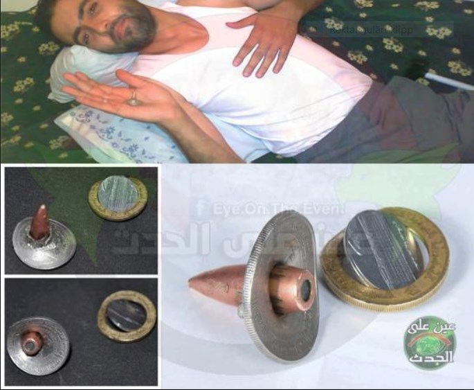 Novčić mu spasio život: Zaustavio metak u zadnji tren!