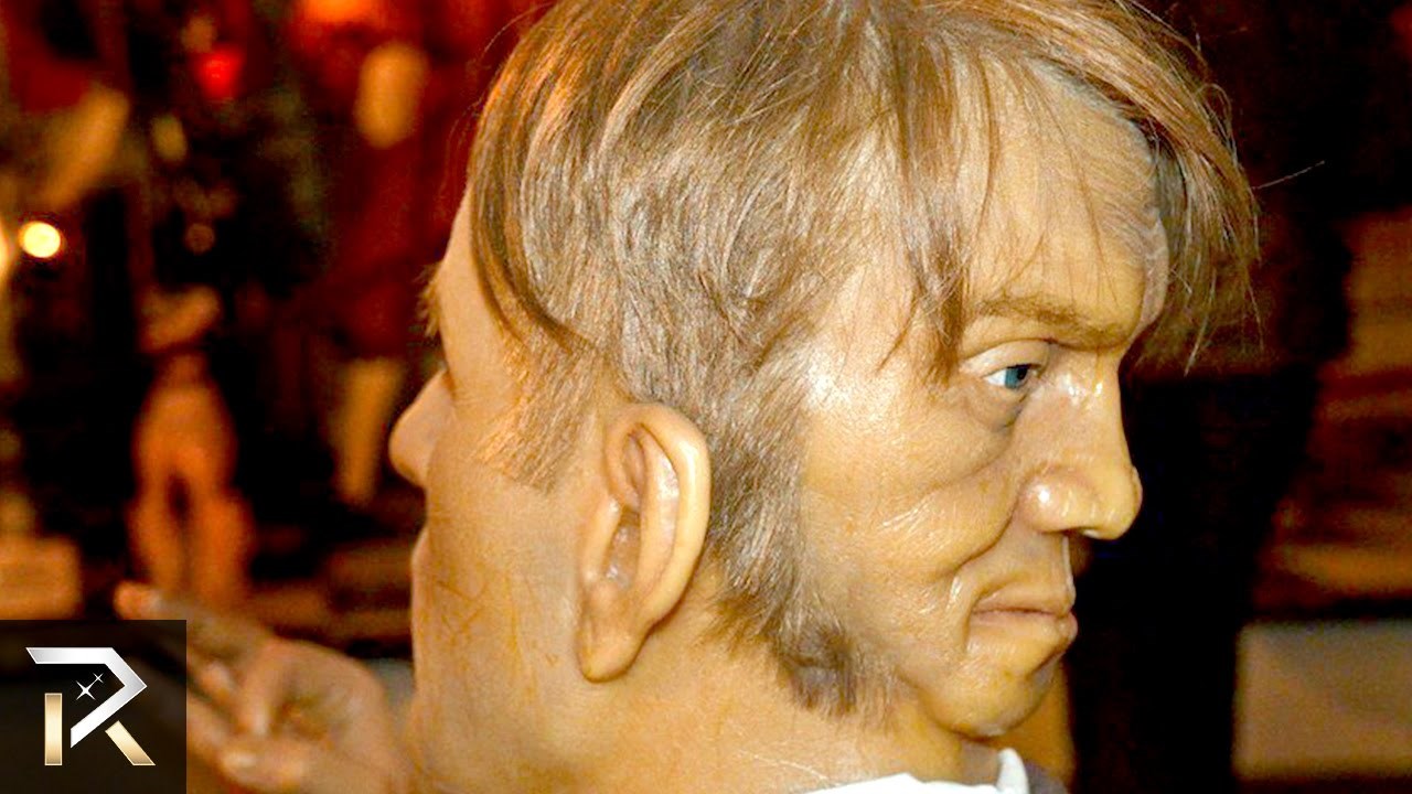 TOP 10 primjera ljudi rođenih s dodatnim udovima!