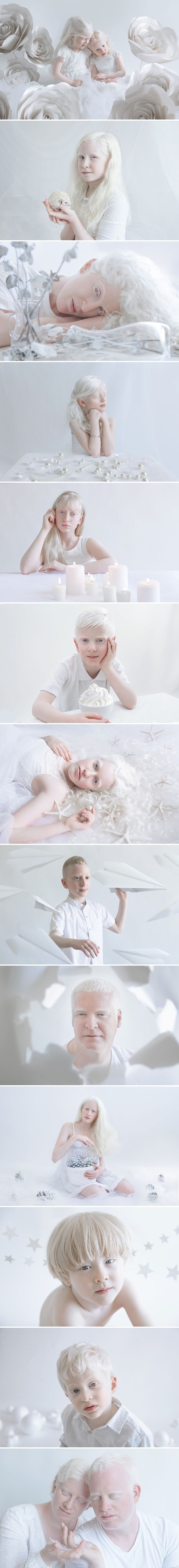 Fotografkinja je ljepotu ljudi s albinizmom prikazala na jedan vrlo poseban način