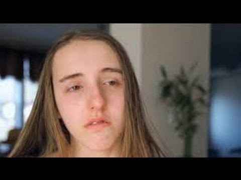 Djevojka kojoj su se u školi rugali zbog velikog nosa, dobila je besplatnu operaciju, evo kako danas izgleda