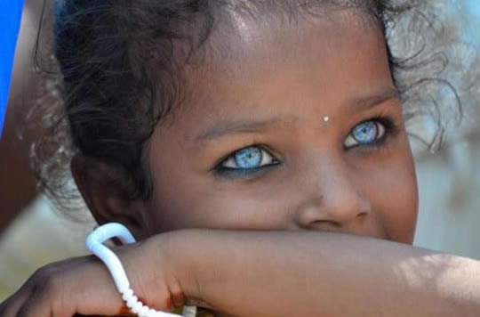 "Vanzemaljske" oči tamnopute djevojčice