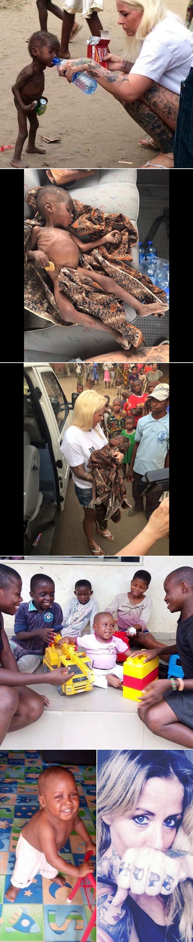 Sjećate li se dječačića kojeg su ostavili da umre jer je "vještac"? Pogledajte ga sad!