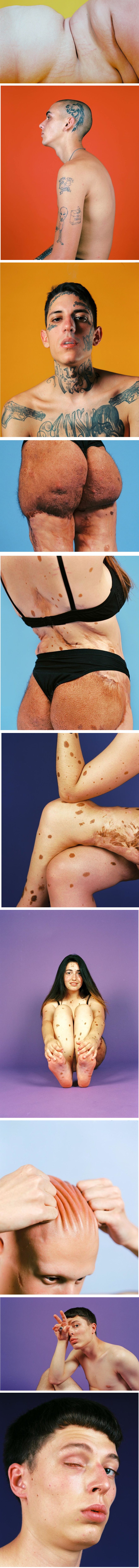 Fotografirao je osobe koje su zlostavljali zbog toga što su različiti kako bi se suprotstavio standardima ljepote