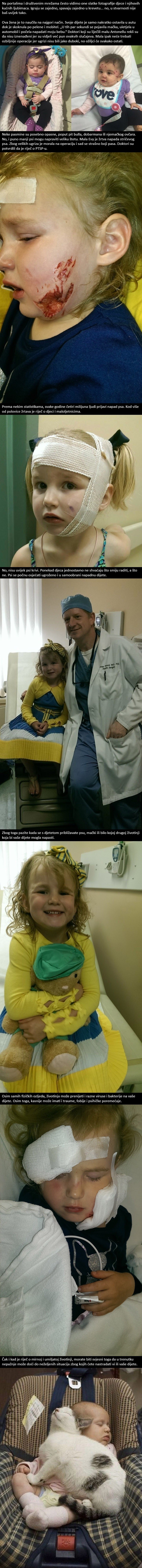 OVO SVI RODITELJI MORAJU VIDJETI! Beba je imala ozljede na licu, a evo zašto!