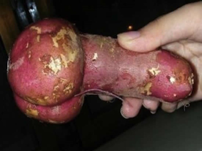 Krumpir spreman za akciju