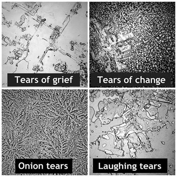 Različite vrste suza pod mikroskopom