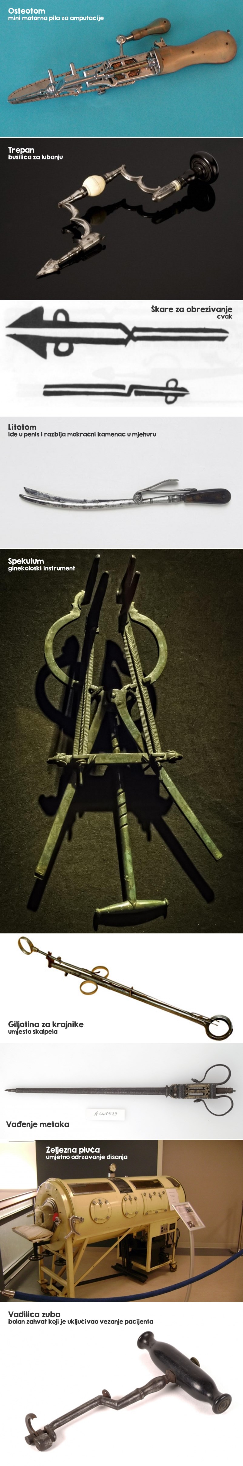 GALERIJA: Jezivi medicinski instrumenti iz prošlosti bude noćne more