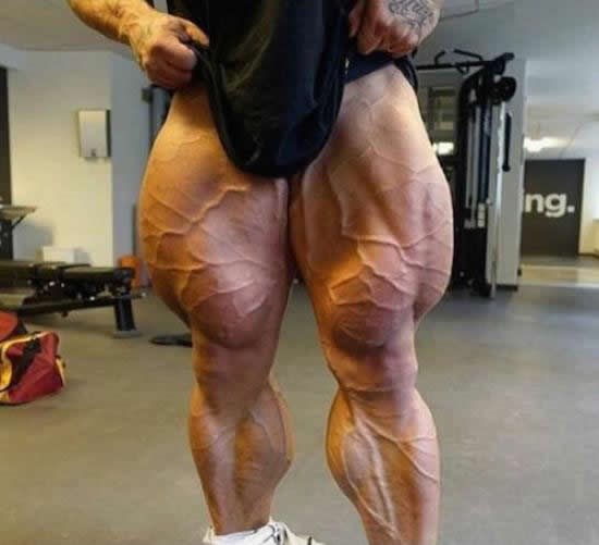 Čuo samo za "dan za noge"