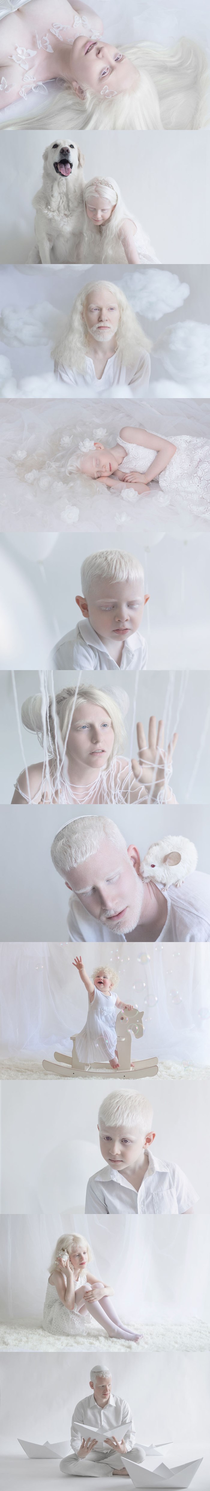 Hipnotizirajuća ljepota albino ljudi - fotografije kakve niste vidjeli do sada 