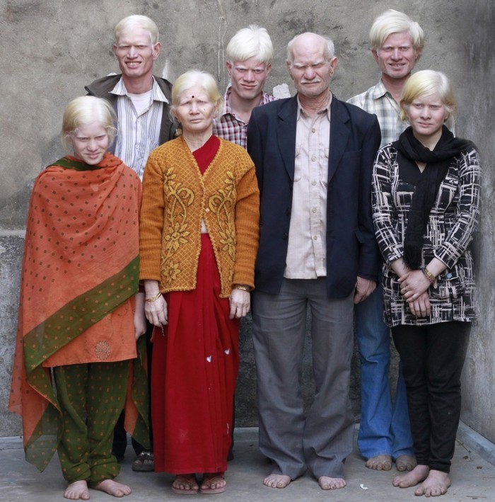 Indijska albino obitelj ponosno pozira za rekord