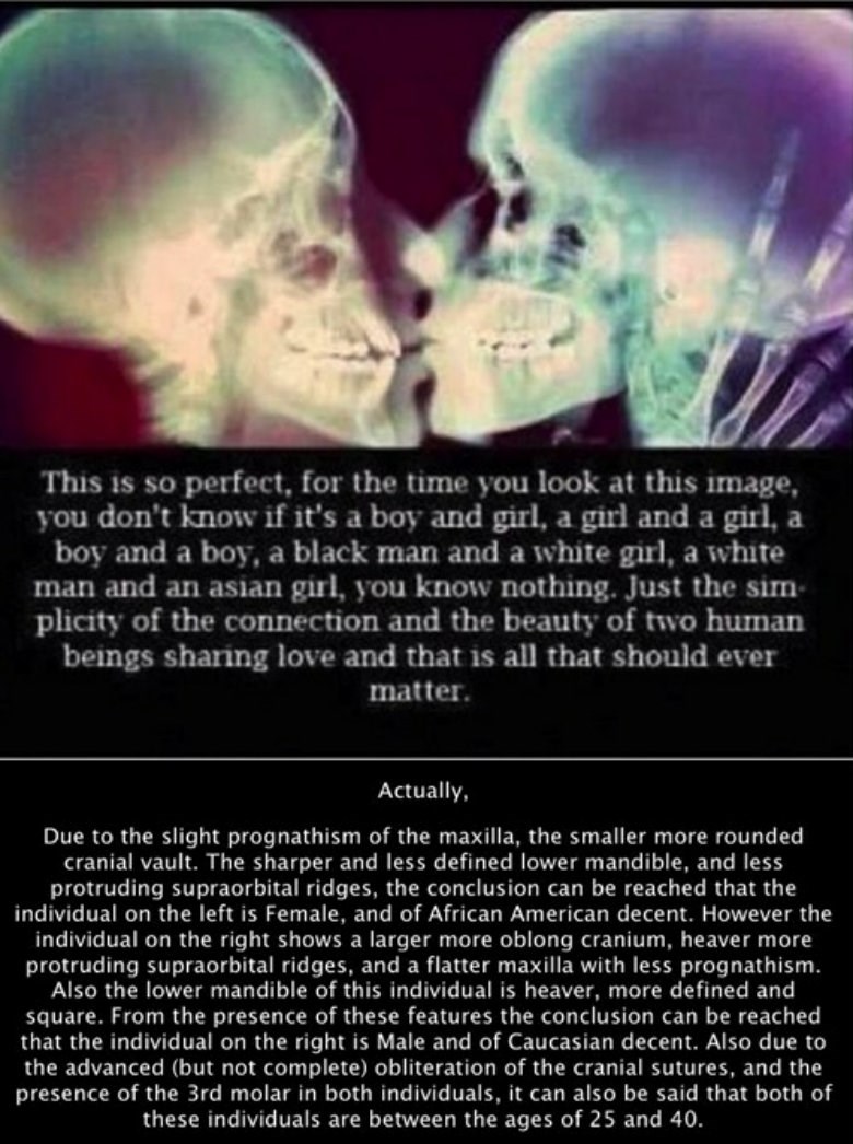 Ispod kože smo svi isti? KRIVO!