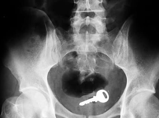 Kad pravi majstor zagubi ključeve