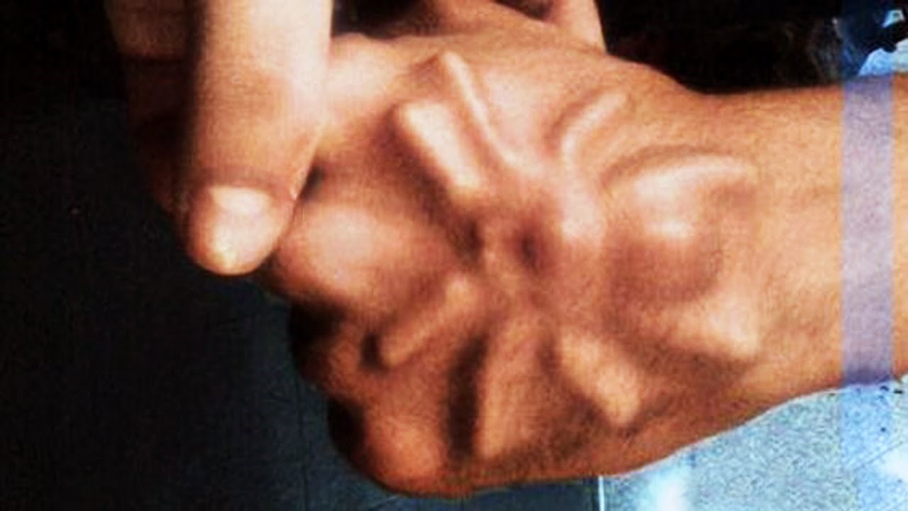 VIDEO Deset zastrašujućih otkrića: Zbog bolova su posjetili doktora i saznali da u svom tijelu imaju goste