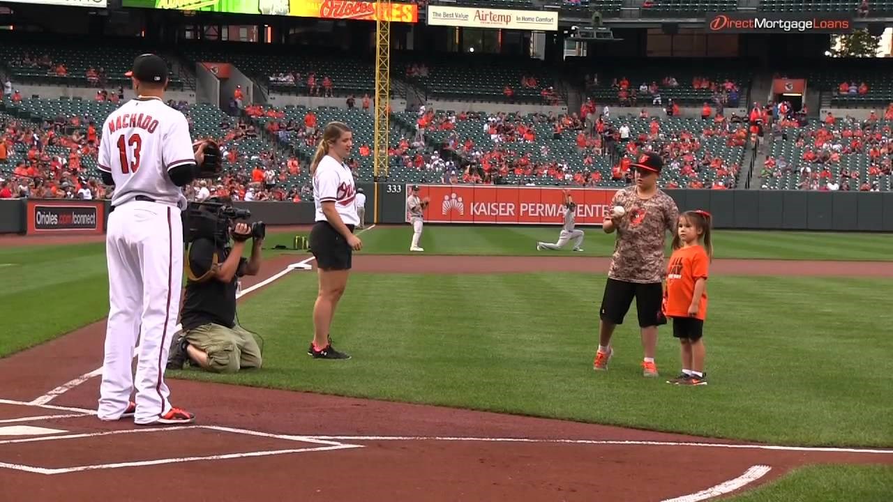 VIDEO: Djevojčica bacila prvu lopticu - 3D printanom protezom!