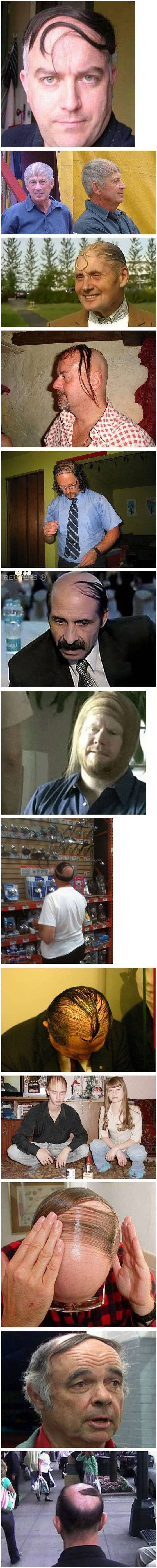 Galerija: Uopće ne kužite da su ćelavi