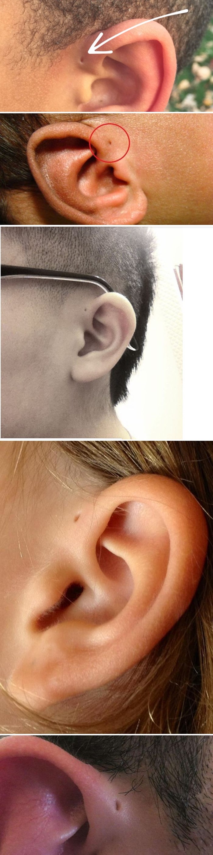 Znate li nekoga s ovakvim rupicama na ušima? Stručnjaci imaju objašnjenje koje bi vas moglo začuditi!