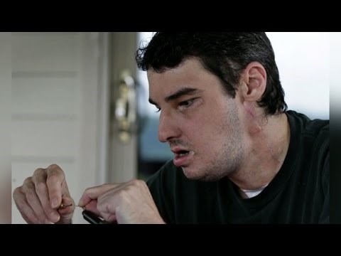 Ostao je bez pola lica, a liječnici su izveli "nemoguću" operaciju i spasili stvar