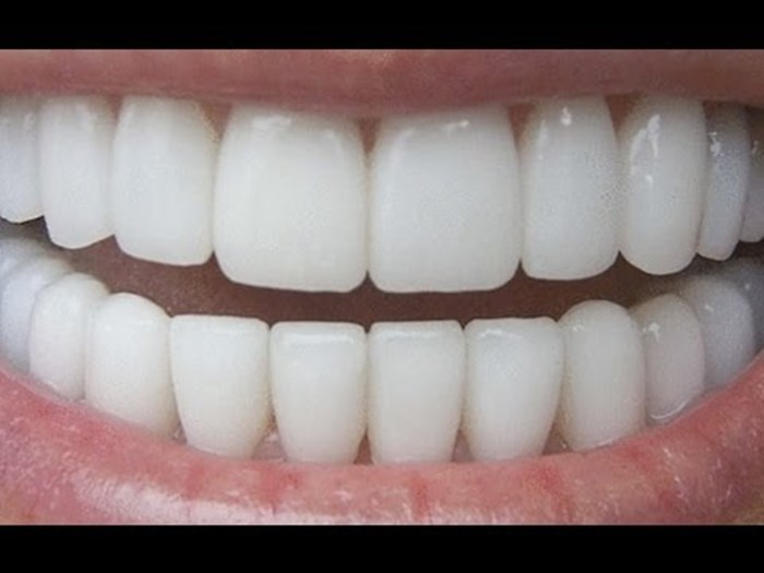 Ovako možete izbijeliti zube u samo tri minute