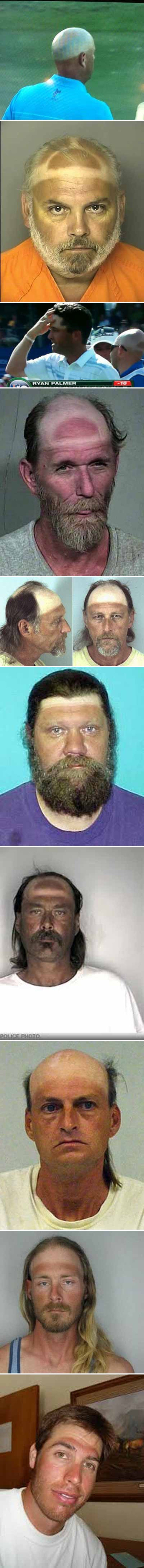 Deset najsmješnijih fotografija ljudi koji su predugo nosili kape i šilterice