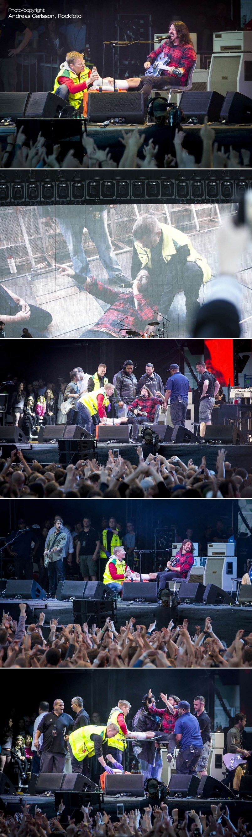 GALERIJA: Dave Grohl ušao u legendu - slomio nogu i nastavio koncert!