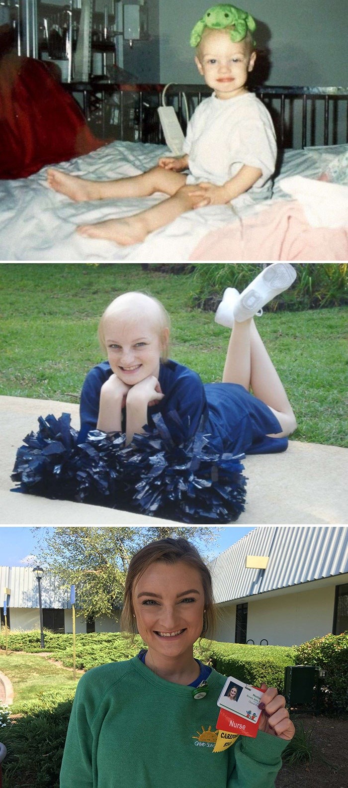 Mlada djevojka dva puta pobijedila rak i u bolnicu se vratila kao medicinska sestra