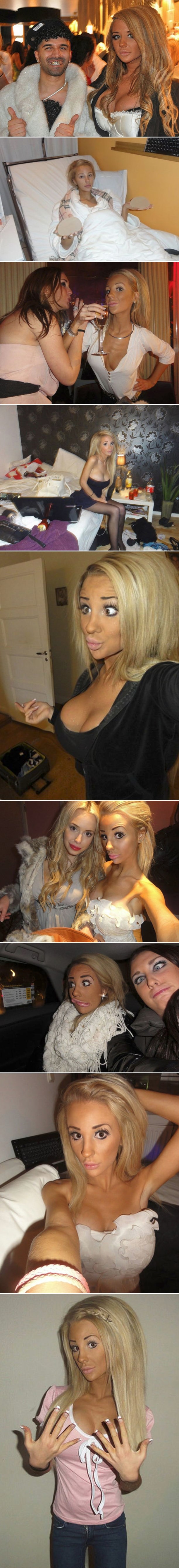 Galerija: Kako izgledaš nakon 24 plastične operacije