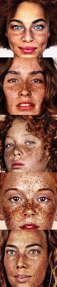 Jedinstvena ljepota pjegica, pogledajte ih sve