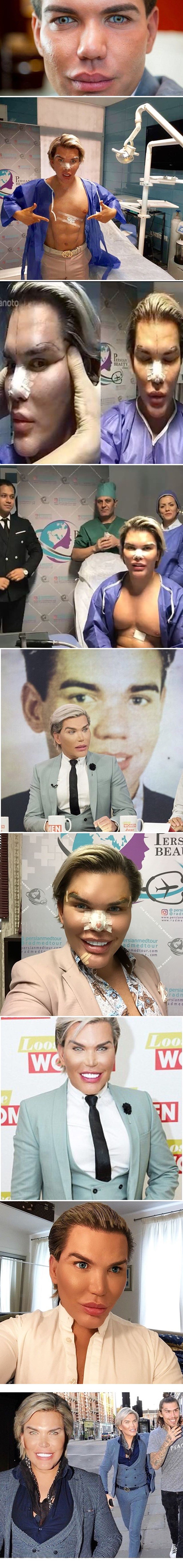 Nakon više od 40 estetskih operacija, brazilski lutak Ken konačno odustaje