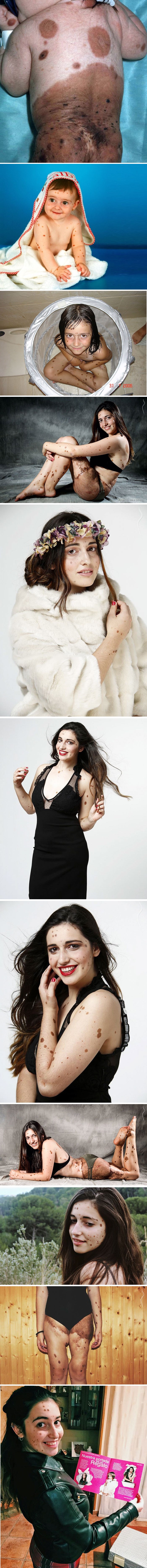 Cijelog su je života maltretirali i ismijavali zbog izgleda, no ona je odlučila stati tome na kraj