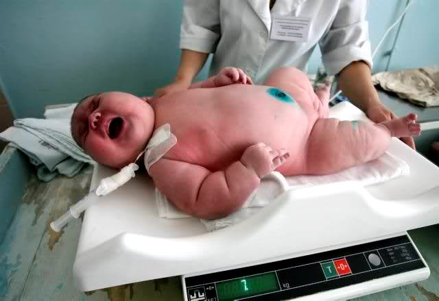 Beba div zabezeknula doktore